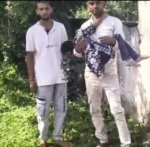 6 साल की बच्ची पर गिरा लोहे का गेट, कमर और मुंह पर आई चोटें, स्ट्रेचर नहीं मिला तो अस्पताल में भटकते रहे पिता